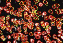 Tech: The tool, called CaImAn, replaces the process of manually tracking the location and activity of neurons — (Report)