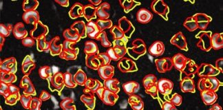 Tech: The tool, called CaImAn, replaces the process of manually tracking the location and activity of neurons — (Report)