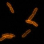 Study: Indiana University researchers have invented technology to watch bacteria build cell walls in real time — (Details)