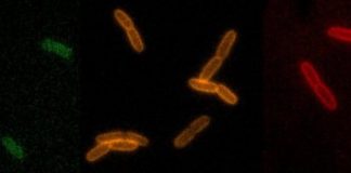 Study: Indiana University researchers have invented technology to watch bacteria build cell walls in real time — (Details)