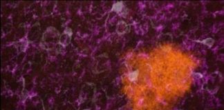 Study: TIGER mouse debuts as model for neurological ailments — (Details)