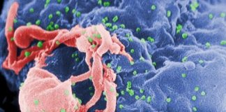 Study: HIV remission achieved in second patient — (Details)