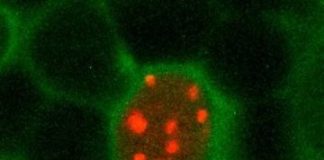 Research: Sleep increases chromosome dynamics that clear out DNA damage accumulated during waking hours —