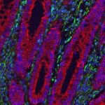 Study: Alternative to anti-inflammatory therapies reduces IBD symptoms in mice — (Details)