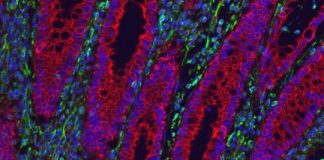 Study: Alternative to anti-inflammatory therapies reduces IBD symptoms in mice — (Details)