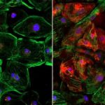 Study: Discovery made while editing genetic defect behind Duchenne muscular dystrophy — (Details)