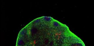 Study: Scientists produce brain organoids with primitive eyes using computational fluid dynamics — (Details)