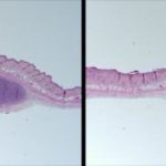 Study: The novel model mimics human acne and introduces new possibilities for targeted treatments and vaccines — (Details)