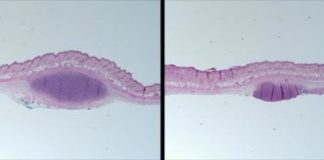 Study: The novel model mimics human acne and introduces new possibilities for targeted treatments and vaccines — (Details)