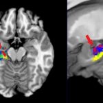 Study: Three ways studying organic chemistry changes the brain — (Details)