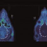 Study: Blocking a type of opioid receptor restores motivation — (Details)