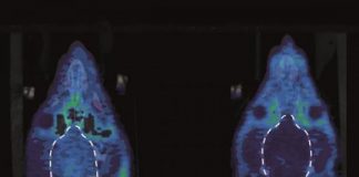 Study: Blocking a type of opioid receptor restores motivation — (Details)