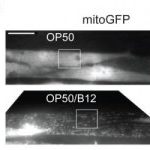Study: Direct link between low-B12 diet, increased risk of infection — (Details)