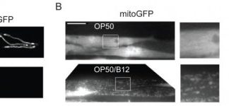 Study: Direct link between low-B12 diet, increased risk of infection — (Details)