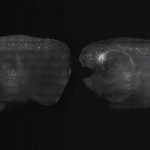 Study: Noninvasive treatment improves memory and reduces amyloid plaques in mice — (Details)