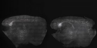 Study: Noninvasive treatment improves memory and reduces amyloid plaques in mice — (Details)