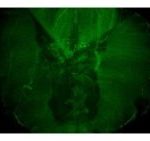 Study: Schwann cells protect nerves against blood clotting factors that cause degeneration — (Details)