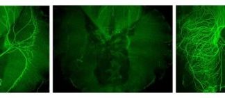 Study: Schwann cells protect nerves against blood clotting factors that cause degeneration — (Details)