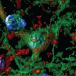 Study: Study may open the door to developing drug therapies or even gene therapies for alcohol addiction — (Details)