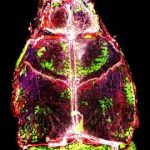 Study: New cell composition may lead to less effective future response — (Details)