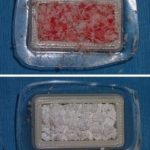 Study: 3D implants made inside the patient — (Details)