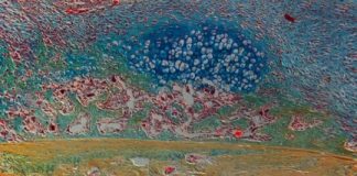 Study: ‘Inflamm-aging’ causes loss of bone healing ability in the elderly — (Details)