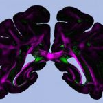 Study: Promising imaging technique for brain research — (Details)