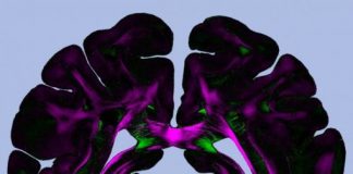 Study: Promising imaging technique for brain research — (Details)