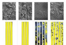 Tech: Human Organ Chips uncover human microbiome metabolites that enhance colon injury by enterohemorrhagic E. coli in human-mouse comparative study — (Report)