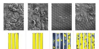 Tech: Human Organ Chips uncover human microbiome metabolites that enhance colon injury by enterohemorrhagic E. coli in human-mouse comparative study — (Report)