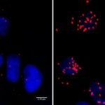 Study: Protein BRCA1 as a stress coach — (Details)