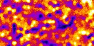 Study: Technique could aid early detection and treatment of certain eye diseases — (Details)