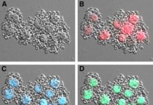 Research: Microbiologists demonstrate apoptosis via bacterial pathogens in single-celled algae. —