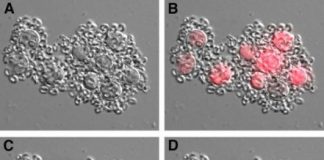 Research: Microbiologists demonstrate apoptosis via bacterial pathogens in single-celled algae. —