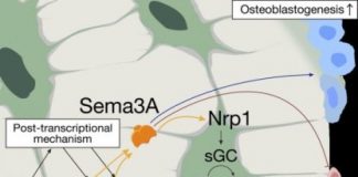 Study: How does estrogen protect bones? Unraveling a pathway to menopausal bone loss — (Details)