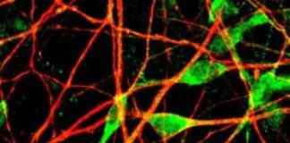 Study: Altered neuron growth and gene expression may be related to why some depressed individuals do not respond to SSRIs — (Details)