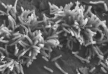 Research: How electricity-eating microbes use electrons to fix carbon dioxide —