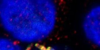 Research: Salmonella could be combated by enhancing body’s natural process —