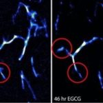 Study: Technique uses well-known dye to watch amyloid plaques in the brain — (Details)