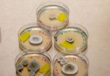 Research: Are no-fun fungi keeping fertilizer from plants? —