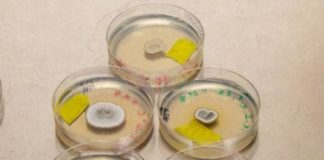 Research: Are no-fun fungi keeping fertilizer from plants? —