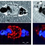 Study: New muscular disease: Myoglobinopathy — (Details)