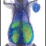 Study: The glow could someday help us use cancer drugs more efficiently — (Details)