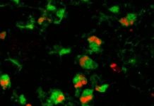 Research: Microglia may benefit, not damage, photoreceptors —