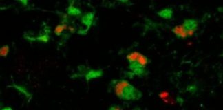 Research: Microglia may benefit, not damage, photoreceptors —