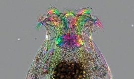 Study: Offspring of older mothers are more responsive to aging interventions — (Details)