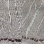 Study: Biologists find a way to boost intestinal stem cell populations — (Details)