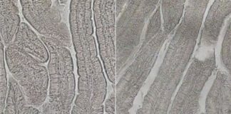 Study: Biologists find a way to boost intestinal stem cell populations — (Details)