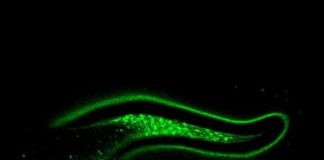 Study: Scientists find brain mechanism that naturally combats overeating — (Details)