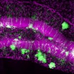 Study: In mice, single population of stem cells contributes to lifelong hippocampal neurogenesis — (Details)